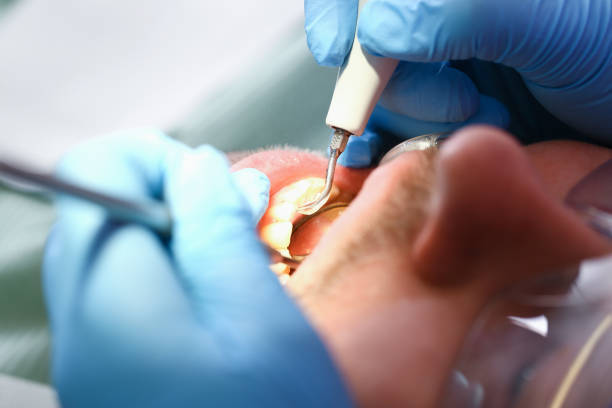 Best Same-Day Emergency Dental Services in Brookneal, VA