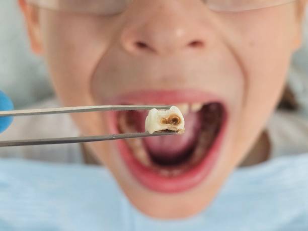 Best Emergency Gum Treatment in Brookneal, VA